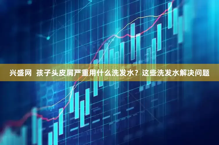 兴盛网  孩子头皮屑严重用什么洗发水？这些洗发水解决问题